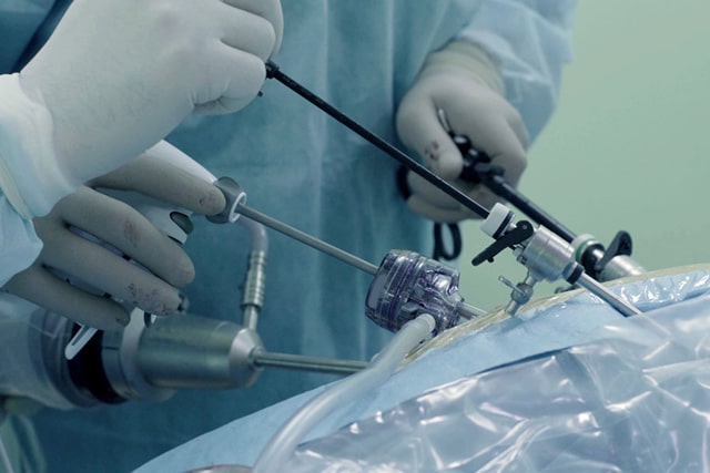 Laparoscopic Surgery