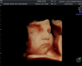 Ultrasound 5D