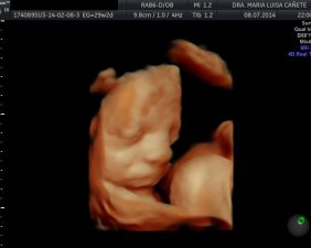 Ultrasound 5D