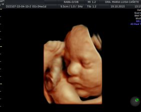 Ultrasound 5D